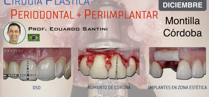 Curso Cirugía Plástica Periodontal y Periimplantar impartido por el Dr. Eduardo Santini en Clínica Dental Doctores Ruz Montilla (Diciembre)