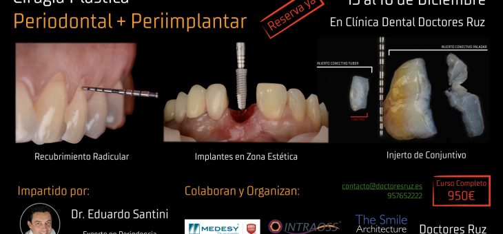 Seguimos trabajando en los cursos de formación! Curso de Cirugía Plástica Periodontal e Periimplantar, impartido por el Dr. Eduardo Santini 